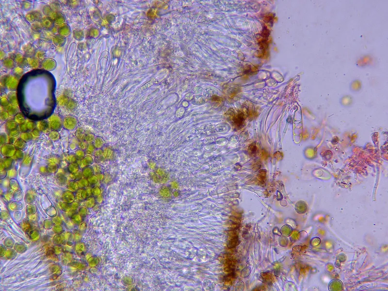 Athallia cerinelloides 10 - Ascos x 400-001